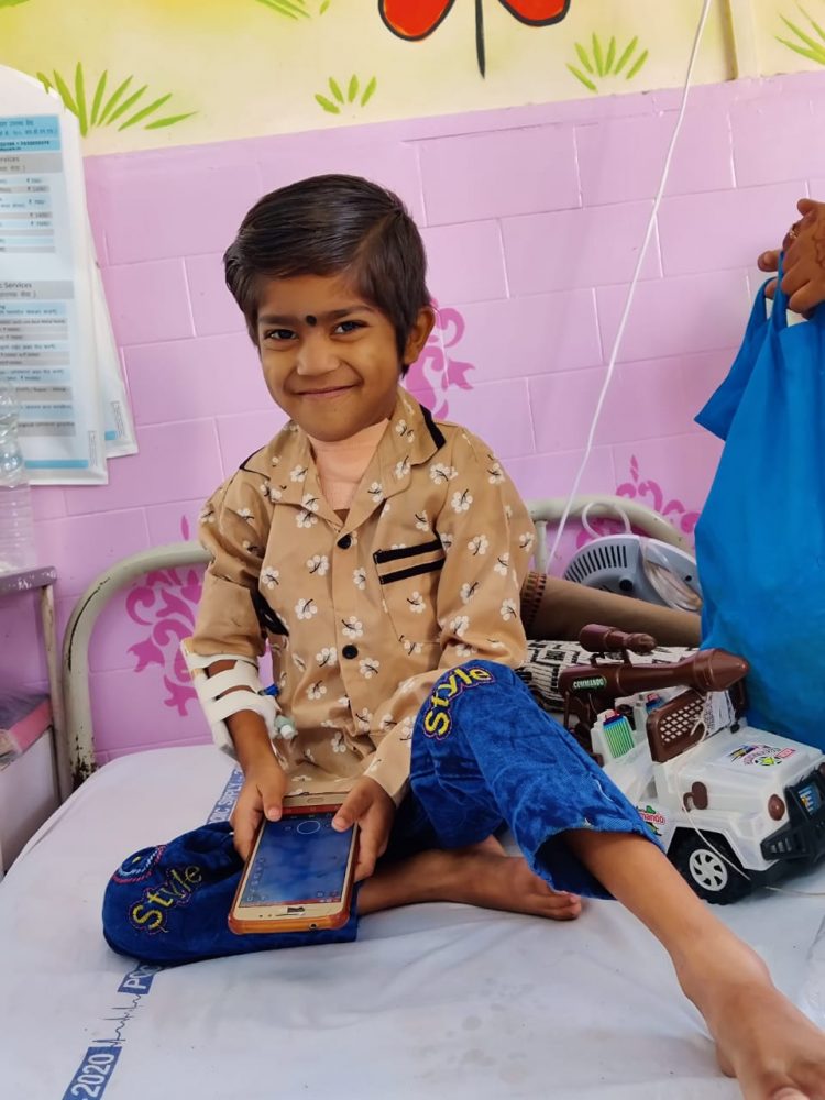 YCM रुग्णालयात ६ वर्षाच्या मुलावर स्वरयंत्राची अत्यंत जोखमीची शस्रक्रिया यशस्वीपणे पार पडली