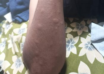 डॉ . बाबासाहेब आंबेडकर विद्यार्थी वसतीगृहाची आम आदमी  शिष्टमंडळाने केली पाहणी