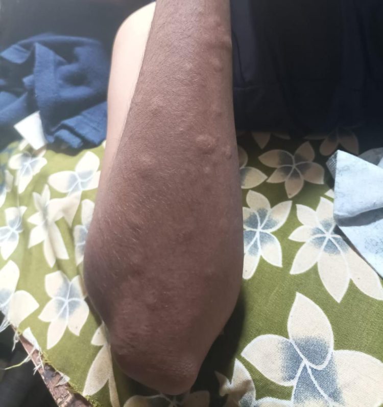 डॉ . बाबासाहेब आंबेडकर विद्यार्थी वसतीगृहाची आम आदमी  शिष्टमंडळाने केली पाहणी